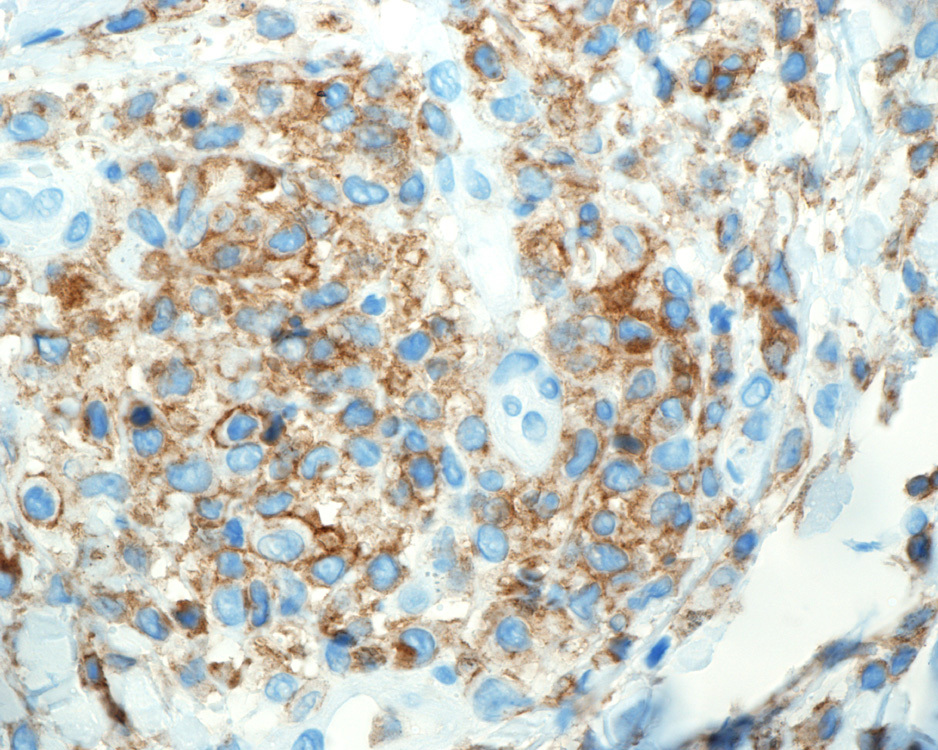 CD4